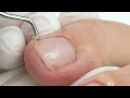 Pedicure for Beginners from A to Z | Toenail Transformation