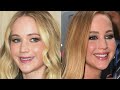 Jennifer Lawrence's Plastic Surgeries: The High Cost of Perfection