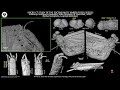 2.- THE AMBER FOSSIL MAYFLY SPECIES Calliarcys antiquus Godunko, Alba-Tercedor & Staniczek, 2022