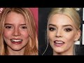 The Extensive Plastic Surgeries of Anya Taylor Joy; So Much So Young