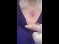 infected dermal (perfume in it ?) Let's try to heal it
