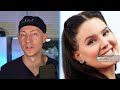 Lana Del Rey's SHOCKING Transformation | Plastic Surgery Analysis