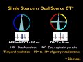 Cardiac CT Physics