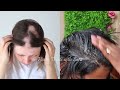 OMG! - 15 Days Hair Growth Miracle Treatment | Grow Long, Thick hair | 100% Works