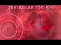 testicular torsion