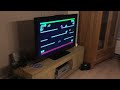 Atari 5200 via rf demodulator to a frame meister