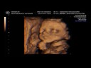4D ULTRASOUND! IMAGES ARE INSANE! #2 Nicholas Ultrasound