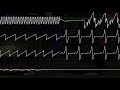 Guile's Theme SNES [Oscilloscope View]