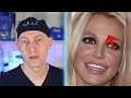 Britney Spears NEW FACE | Plastic Surgery Analysis