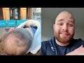 BALDING MAN DISTRAUGHT After Shaving Head BALD *Emotional*