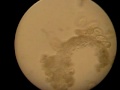 Paramecium under microscope III.