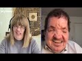 S2 E20  Life With Apert Syndrome  A Conversation With Dorsey Ross