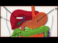 Gallbladder: Cholelithiasis vs Cholecystitis vs Choledocholithiasis vs Cholangitis [Made Easy]