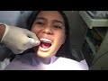 Braces Q&A: Does It Hurt? (Philippines)  | ThatsBella