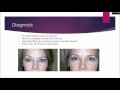 Lecture on eyelid and brow  ptosis