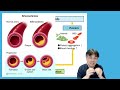 สุขภาพดีเกินล้านวิว : กินอะไรสามารถล้างหลอดเลือดที่อุดตันได้  ( Unclog blood vessel )???