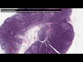 Histologie Lymphatische Organe (Lymphknoten, Milz, Tonsillen, GALT, Thymus) - AMBOSS Video