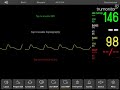 Cual hospital moniter thingy