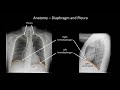 How to Interpret a Chest X-Ray (Lesson 2 - A Systematic Method and Anatomy)