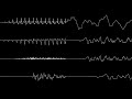 Donkey Kong Country 3: Bonus Time! [Oscilloscope View]