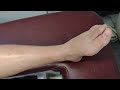 0. MHE Knee Relocation introduction