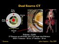 Physics of Dual Energy CT (DECT)