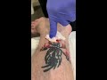 BRUTAL Steroid Injection Into Ugly Tattoo