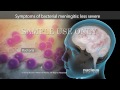 Viral Meningitis