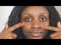 How to get rid of dark circles, hyperpigmentation and acne in 5 days