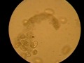 Paramecium under microscope IV.