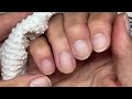 How to remove gel from your nails [without destroying them!]