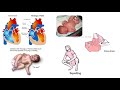 Different patient Positioning / Patient positions used in different procedures