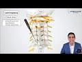 Laminoplasty - Motion preservation spinal cord decompression. Procedure, Risks, and Restrictions.