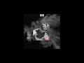 I Em On Top [Explicit] | Neev Basoya | Official Audio Song