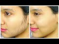Remove Facial Hair PERMANENTLY - Ubtan Face Pack | Anaysa