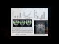 CARTA: Uniquely-Human Features of the Brain: Specialization from The Cellular to Structural Scale