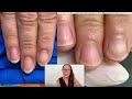 How to make wide nails more narrow.