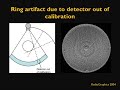 CT Artifacts Patient-based Artifacts