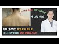 목, 어깨 통증은 사실 경추의 OO 때문입니다. 이 부분을 모르면 평생 고생!!