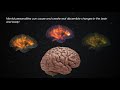 Neuroscientific Evidence: Irreducible Mind (Part 1)