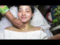 Pimple marks නැති කරන මැජික් එක! 😱 #vlog #skincare #skintreatment