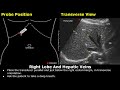 Liver Ultrasound Probe Positioning | Transducer Placement For Liver Scanning | Abdominal USG