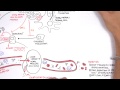 Multiple Myeloma - signs and symptoms, pathophysiology, treatment