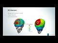 The Finite Element Method (FEM) - A Beginner's Guide