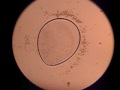 Paramecium under microscope V.