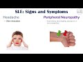 Lupus Signs & Symptoms (& Why They Occur) | Skin, Joints, Organ Systems
