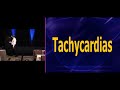Bradydysrhythmias and Tachydysrhythmias | Heart Course ECG Workshop