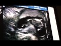 Baby Pogue Ultrasound