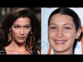 What Happened to Bella Hadid's Face? Plastic Surgeon Reacts