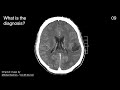 Brain CT Scan Quiz #1 - 10